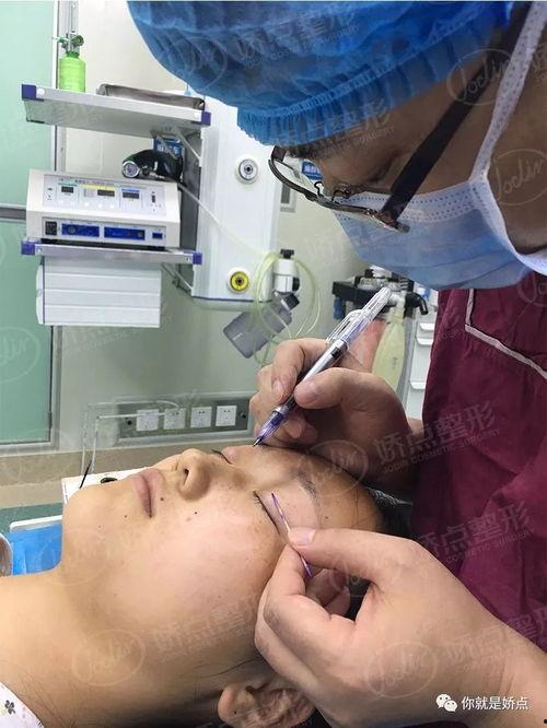 整形手术回顾,技术革新与美丽追求的历程